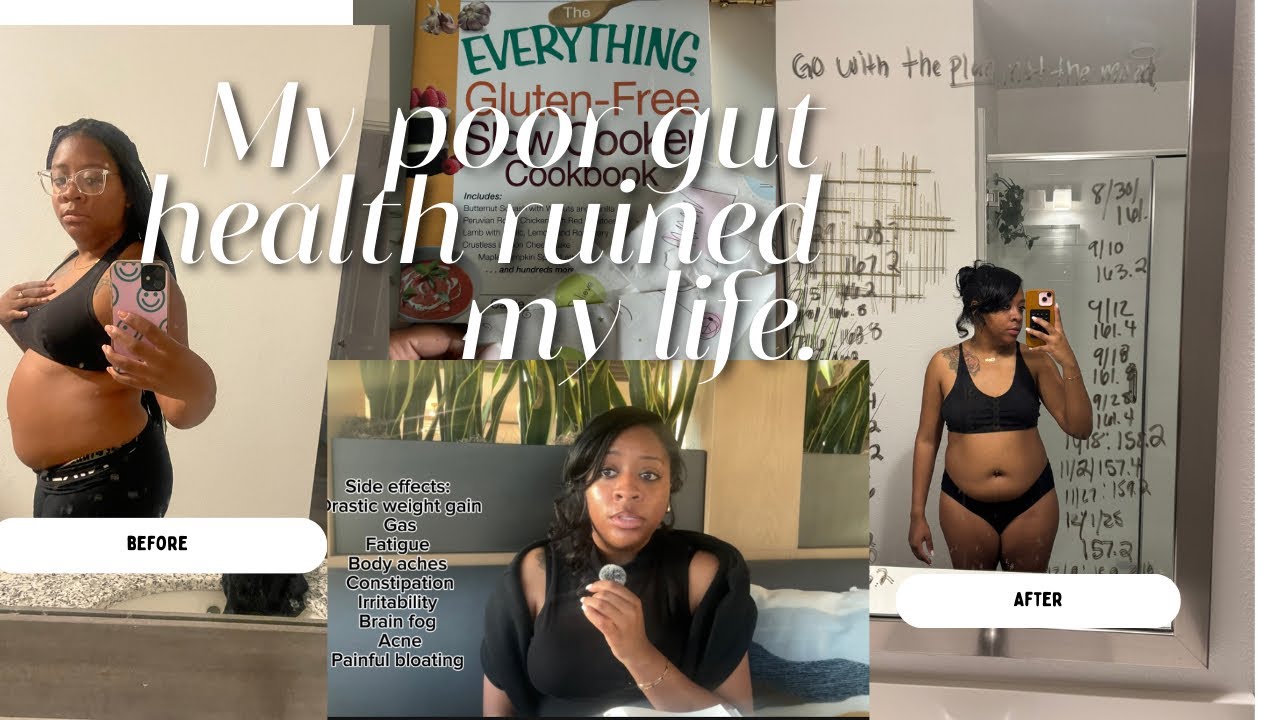 MY GUT HEALING JOURNEY | how healing my gut changed my life + Celiac disease |  