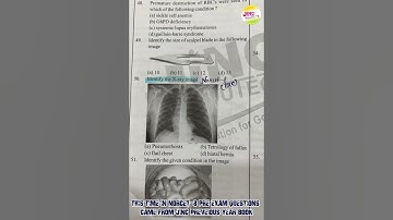 This Time in Norcet -8 PRE Exam Questions Came From JINC Preveious Year Book...