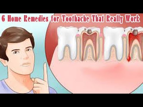 6 Home Remedies for Toothache That Really Work  - Natural Health Cures