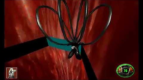 THE END || MDK Level 6