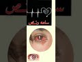انتحار اب لديه 9ابناء عندما ضاقت به الدنيا الشاعر عبدالله عبدالجليل انتحار اب لديه 9ابناء عندما ضاقت به الدنيا الشاعر عبدالله عبدالجليل