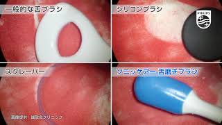 ソニッケアー　舌磨き比較