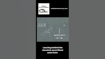 FULL LENGTH VIDEO ON PAGE. Mercury and Neurons. #mercury #mercurypoisoning #neurons #mercuryvapor