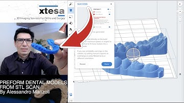 STL DENTAL SCAN TO 3D PRINT MODELS WITH FORM LABS