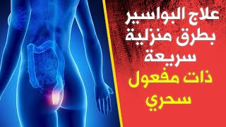 علاج البواسير بطرق منزلية سريعة ذات مفعول سحري علاج البواسير الداخلية والخارجية بأفضل الطرق الطبيعية