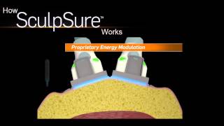 Memphis Non Invasive SmartLipo CALL (901) 610-3986