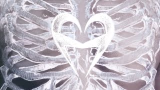 Heartist ~ Skeletons (Sub Español/Inglés) - HD