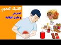 التلبك المعوي الأعراض و طرق الوقاية