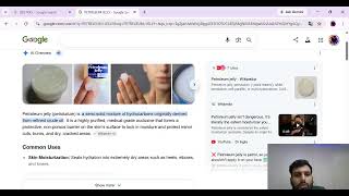 🔥 ORBITAL CELLULITIS LIVE CLASS | Medical Emergency You Should Never Ignore!Orbital Cellulitis