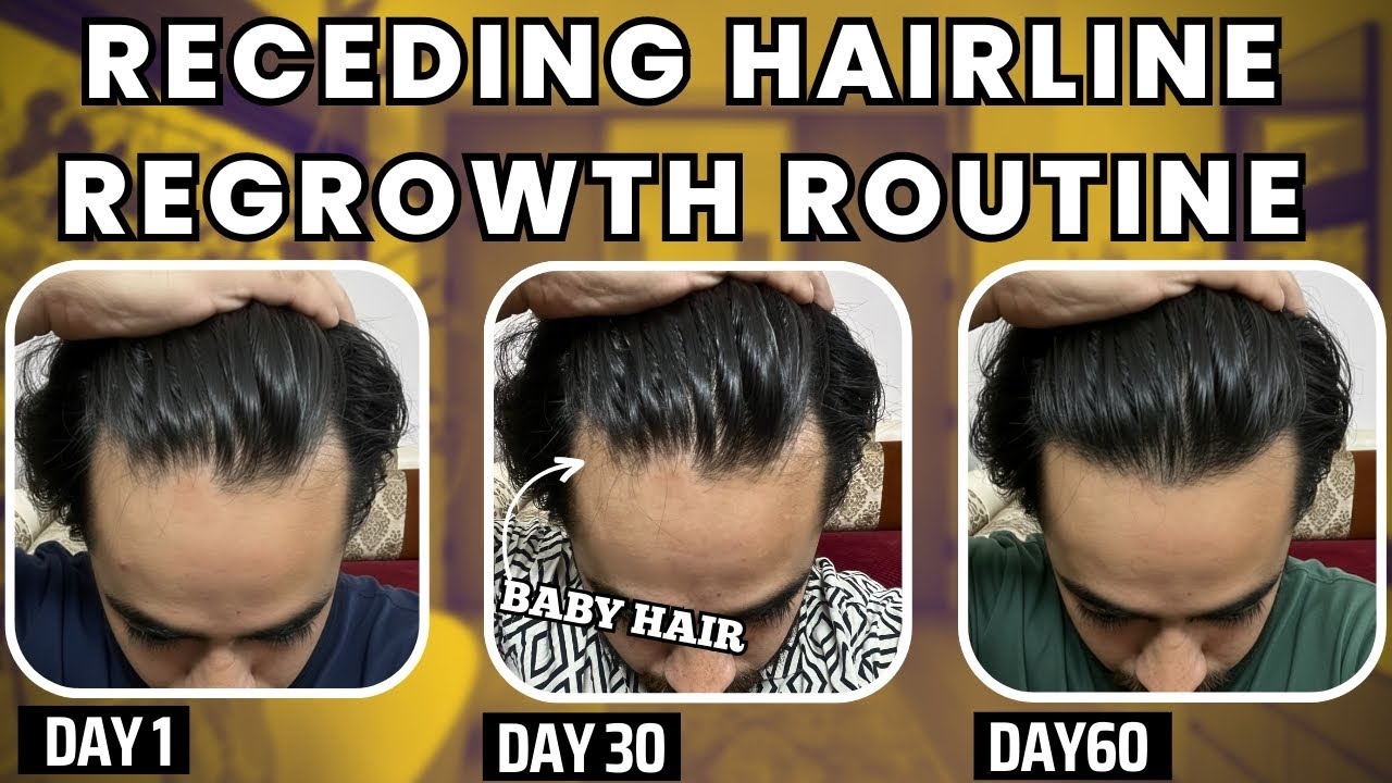 Hairline Regrowth Possible Hai | My Real Routine at 36 No Scam