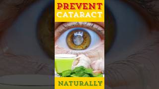 NATURAL Ways to Prevent EYE Cataracts at Home?