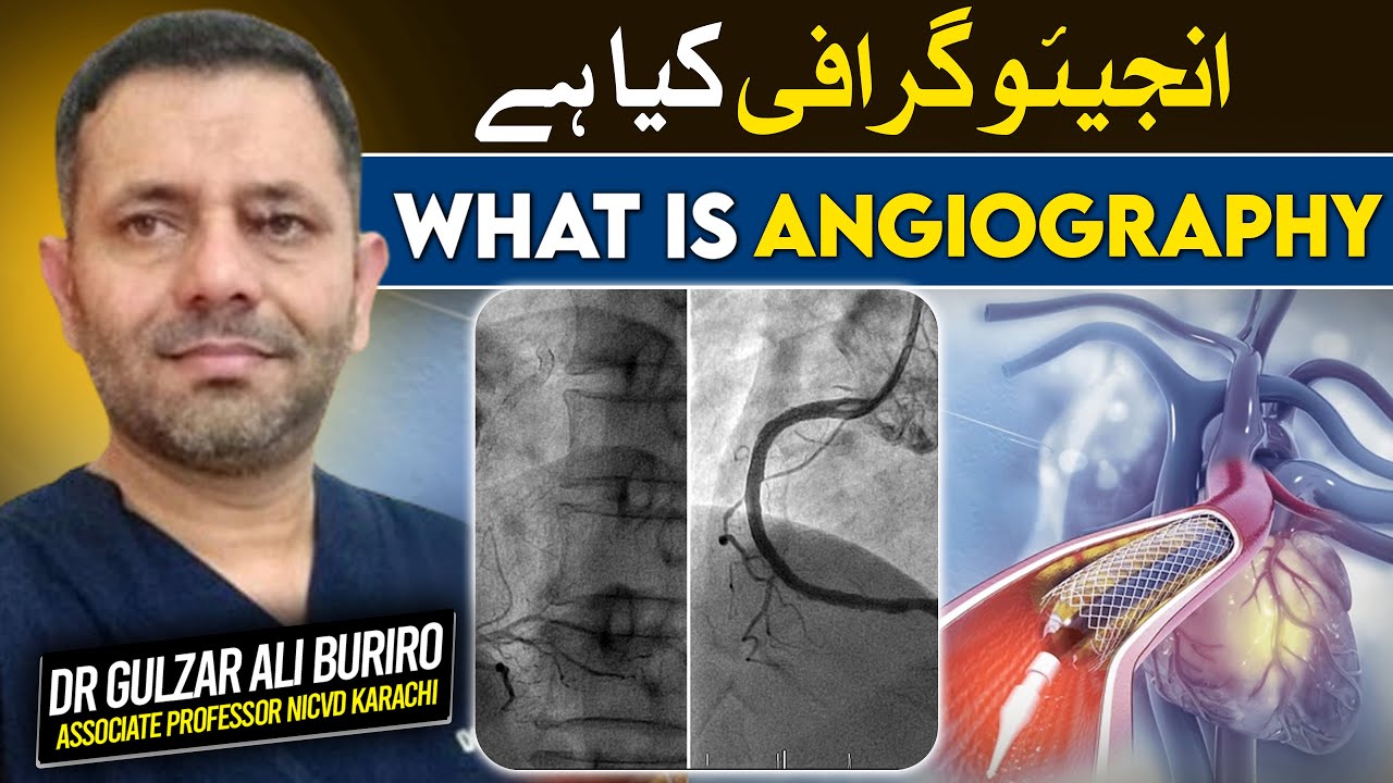 What is Angiography? | Detailed Explanation of Coronary Angiography By ...