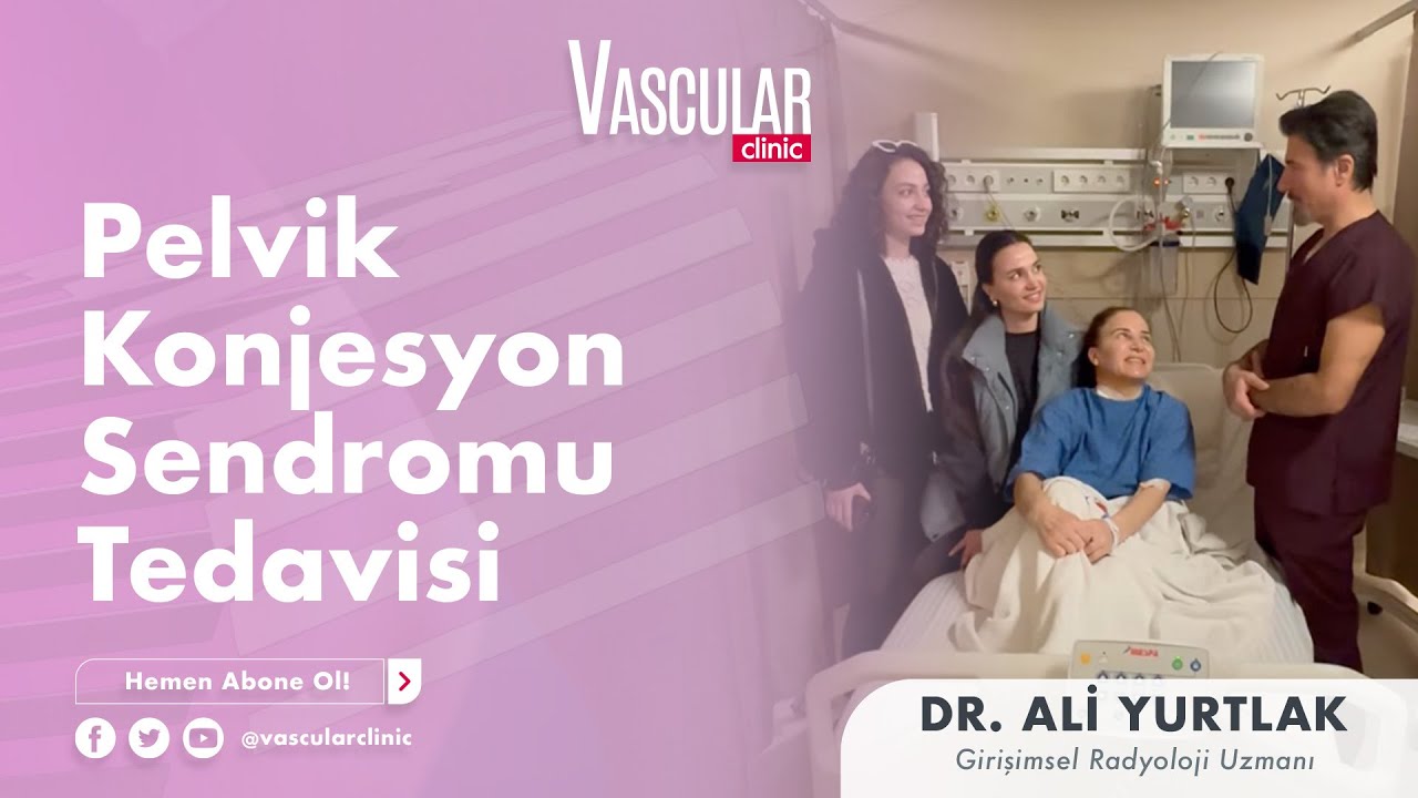 Pelvik Konjesyon Sendromu Tedavisi