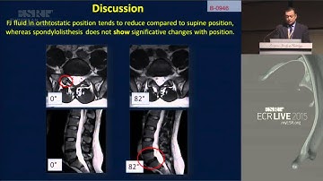 ECR 2015 (European Congress of Radiology) a Vienna