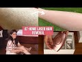 Laser Hair Removal at Home | Permanent Hair Removal Using IPL Laser
