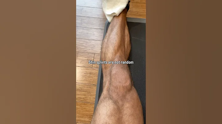 Shin Splint Solutions