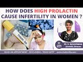 How does hyperprolactinemia high prolactin levels cause infertility in women   ziva fertility