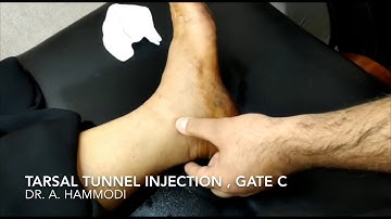 Tarsal Tunnel Injection ( Gate C) technique