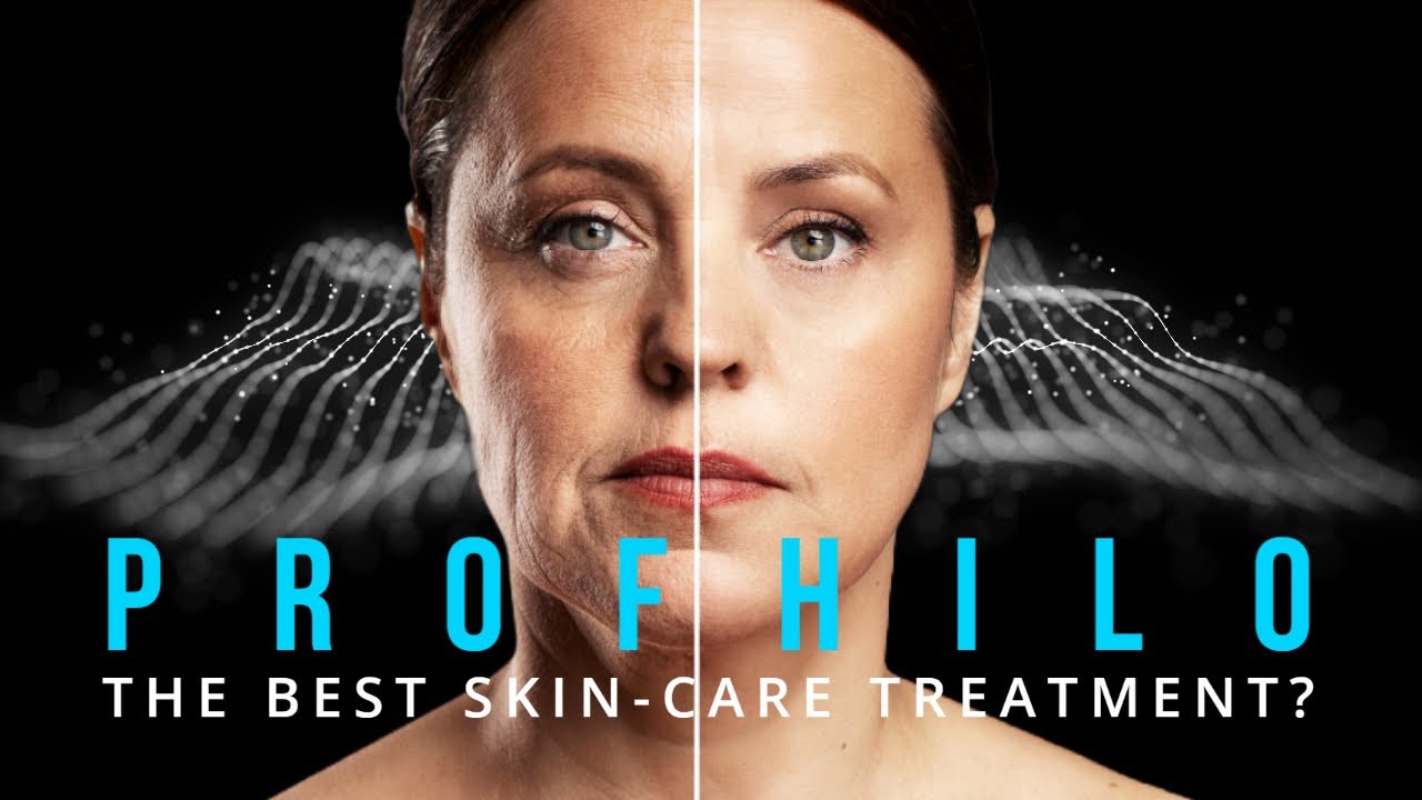 Profhilo: The Best Skin-Care Treatment?