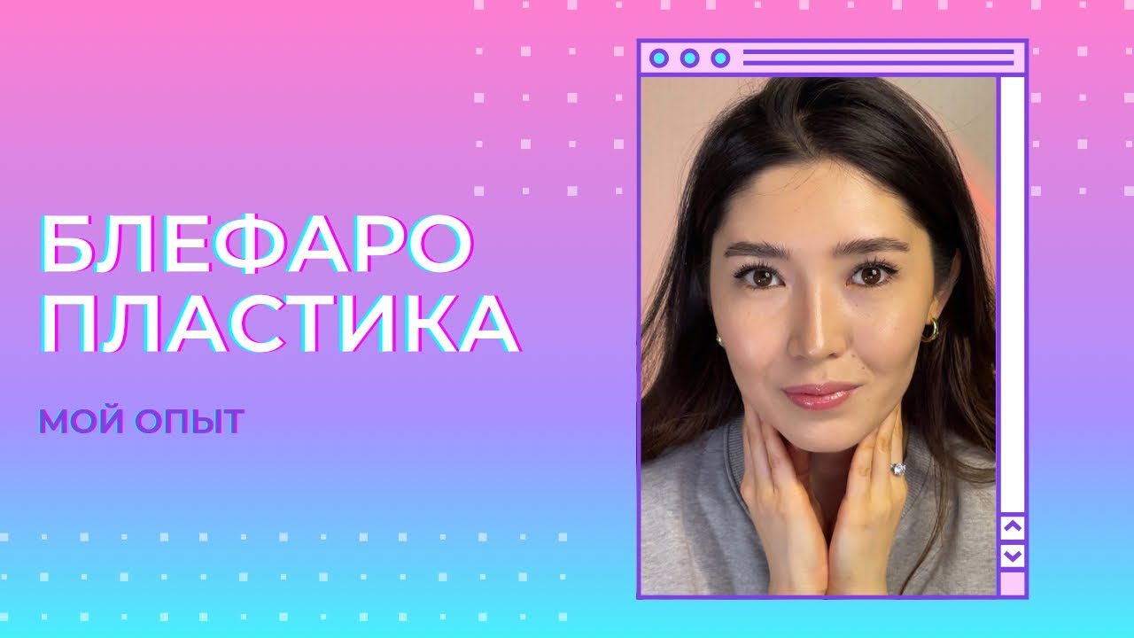 vlog: блефаропластика | осложнения побочки восстановление день за днем