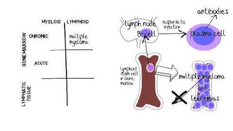 blood cancer clips Multiple Myeloma