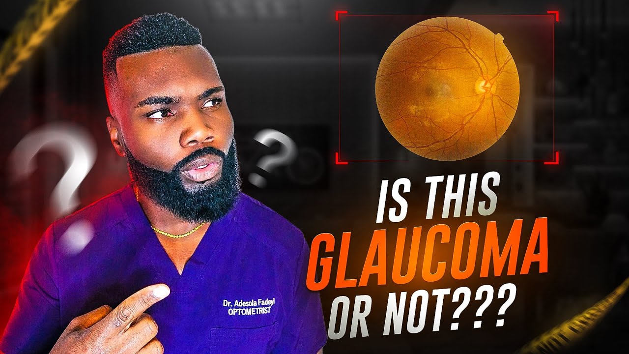 How To Detect Real Glaucoma Vs Fake Glaucoma! - YouTube