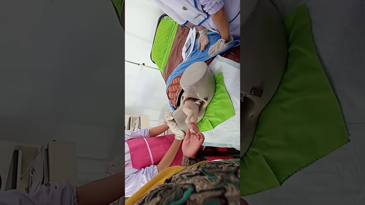 Teknik-teknik Menolong Sungsang