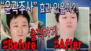 [윤곽주사효과] 세부시티 바소 스킨 클리닉(VASOH SKIN CLINIC) 최신후기 |세부테리 CEBUTERRY|