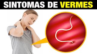 Sintomas De Vermes Sinais Perigosos Para Prestar Atencao Youtube