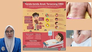 Kenali dan Cegah Penularan Demam Berdarah Bengue (DBD) Pada Anak || Dwi Martha -2B keperawatan