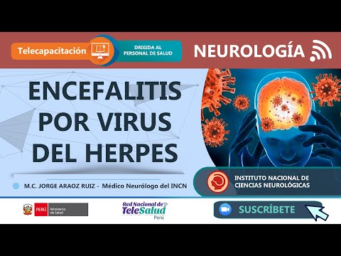 ENCEFALITIS VIRAL HERPÉTICA