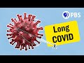 Long covid what do you need to know