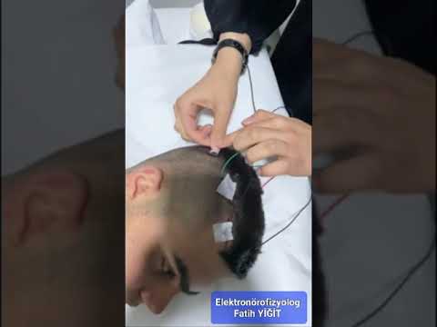 EEG Uygulama Eğitimleri , EEG Çekim Merkezi