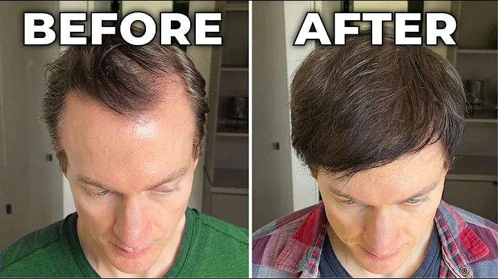 How I Reversed My Hair Loss + Greying - DayDayNews