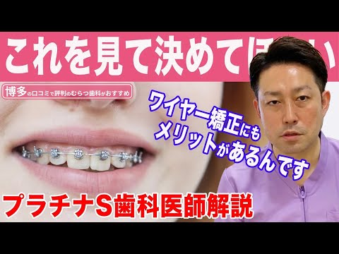ワイヤー歯科矯正　TP Orthodontics TP オリジナルワイヤー | ティーピー・オーソドンテックス・ジャパン