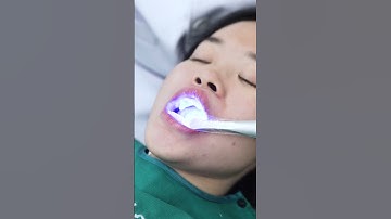 Cùng niềng răng trong suốt Zenyum biến đổi nụ cười trở nên tự tin hơn