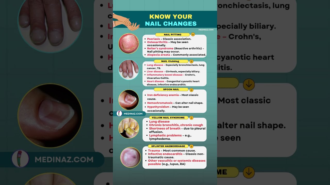 5 Nail Changes That Signal BIG Health Problems