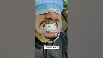 Teeth Whitening Powder Dentistteeth Teethwhiteningproducts Doctor Toothdental 