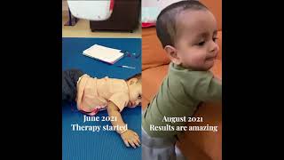 Pediatric Early Intervention Therapy | Physical Therapy Dubai UAE