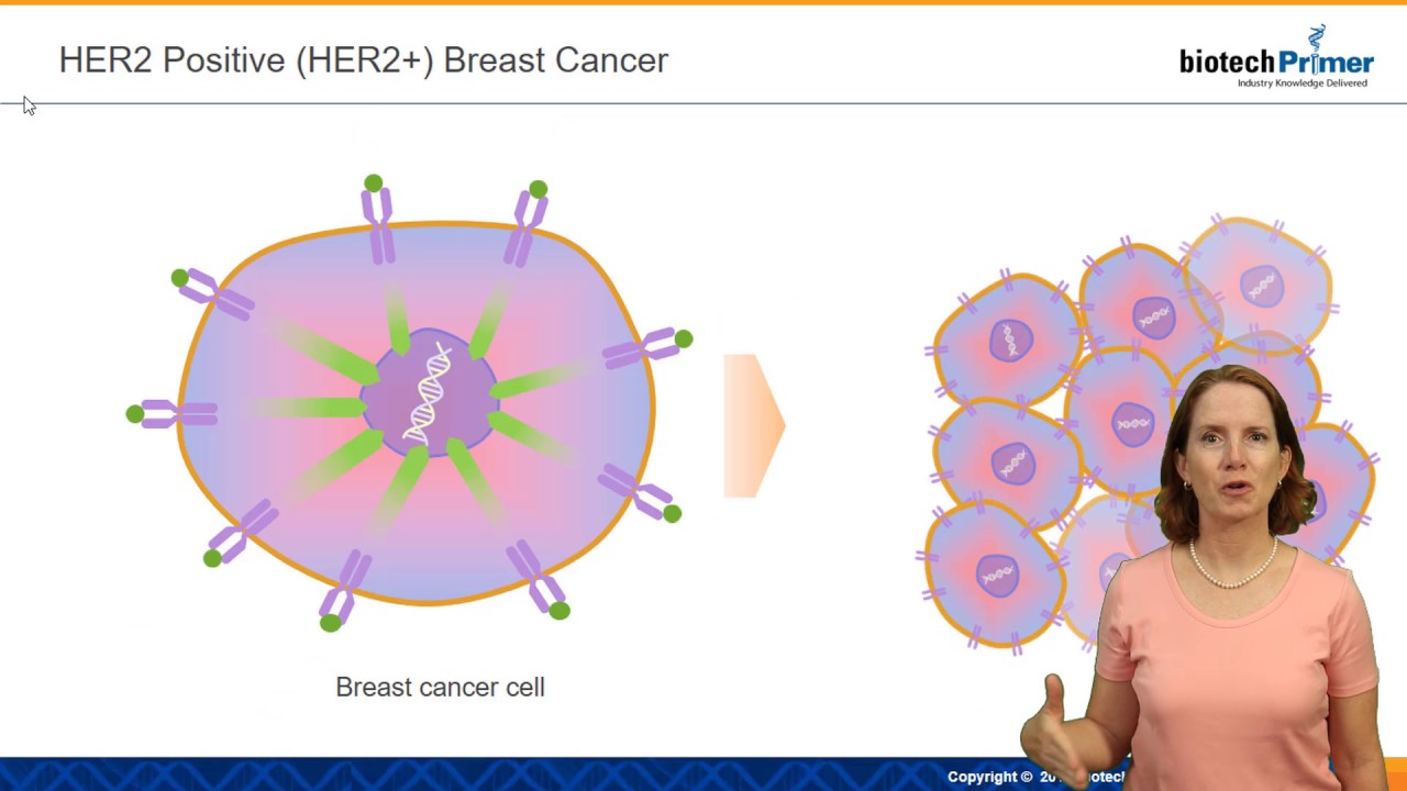 HER 2 + (positive) Breast Cancer YouTube
