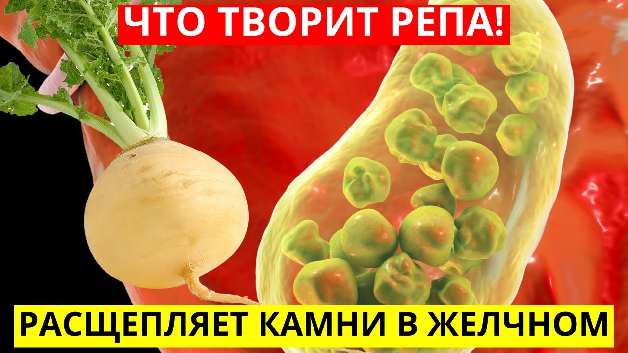 РЕПА Творит Чудеса. Чего Мы Не Знаем О Репе? Польза Или Вред Для Человека.