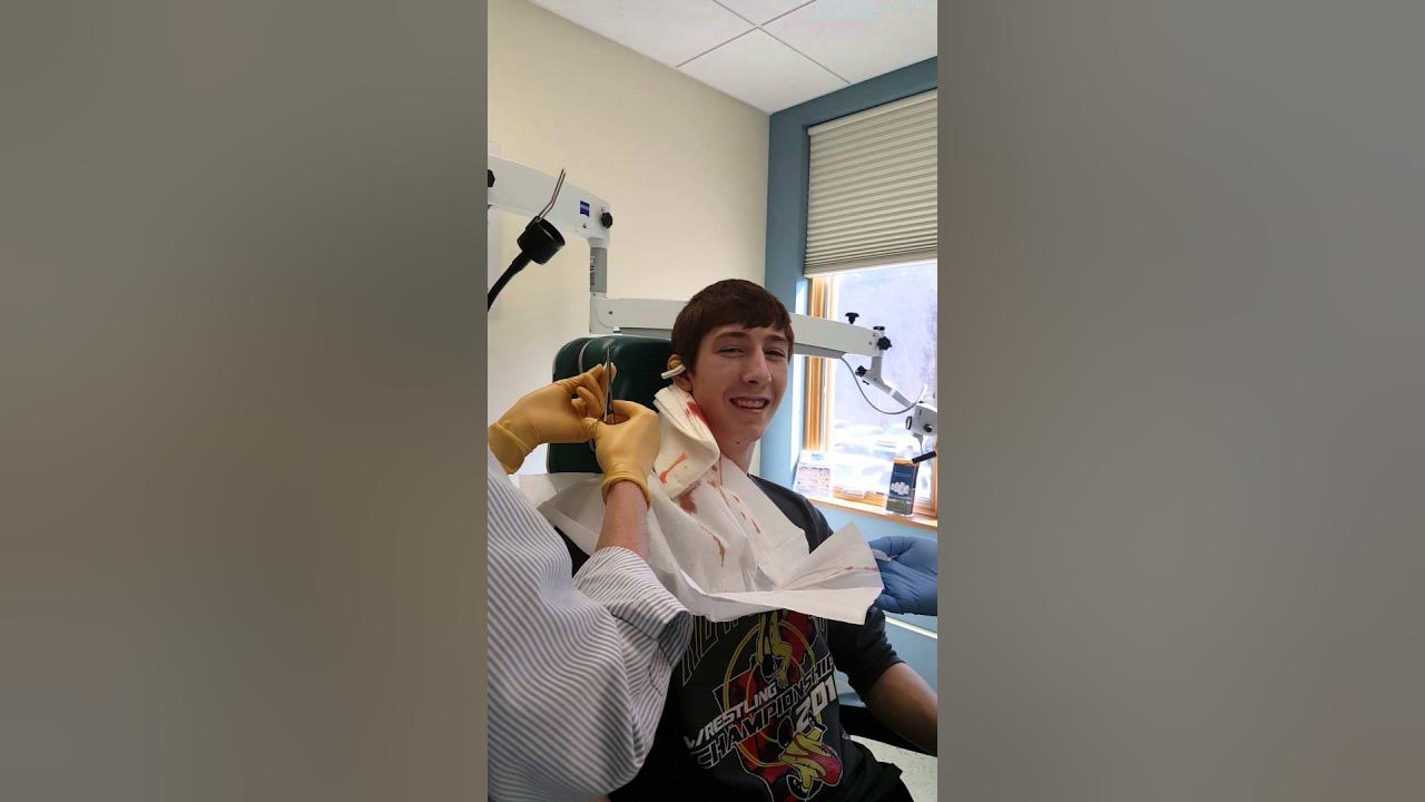 Getting my cauliflower ear drained YouTube