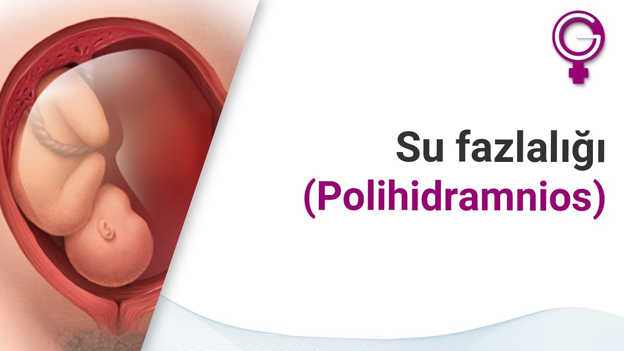 Su fazlalığı (Polihidramnios) nedir?
