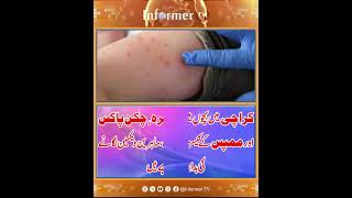 Karachi News | measles cases Karachi | Karachi Health News | Breaking News | Karachi vaccination