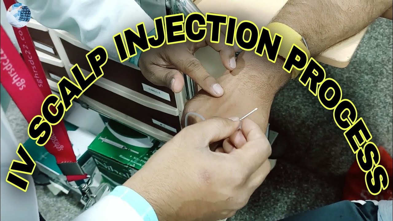 Cannula injection for CECT CHEST #ctscan #cannula #injection ...