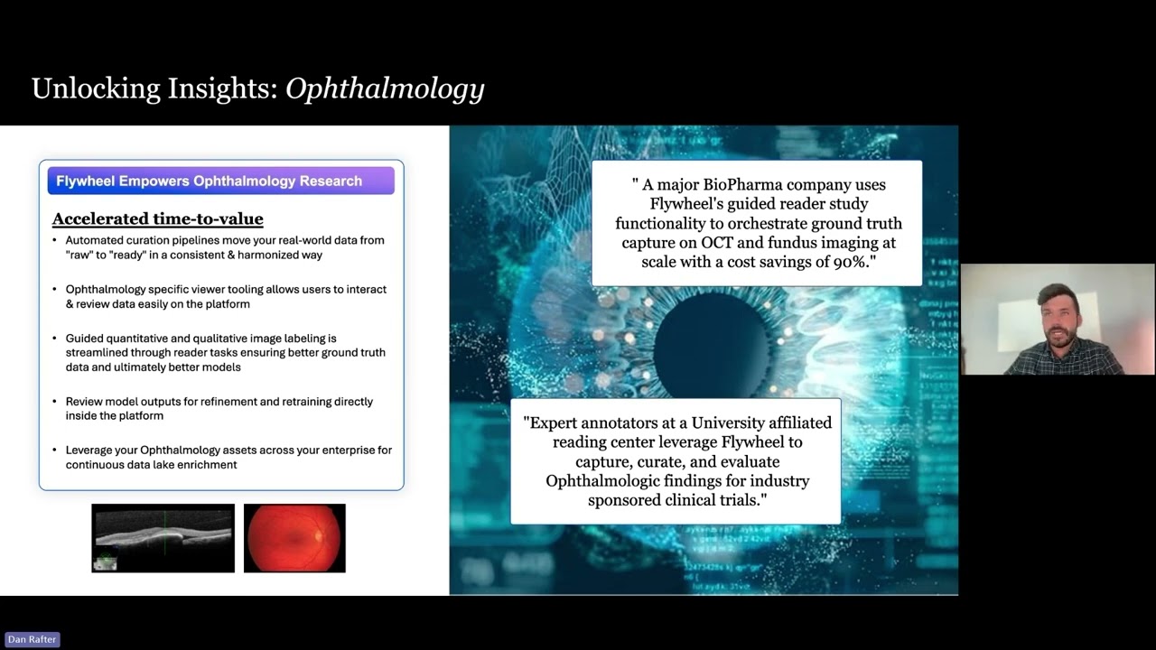 The Medical Imaging Platform for Ophthalmology Research | Flywheel
