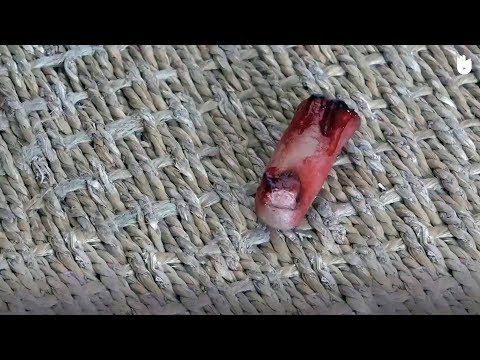 Βίντεο: Πώς να σταματήσετε την αιμορραγία ενός σκύλου