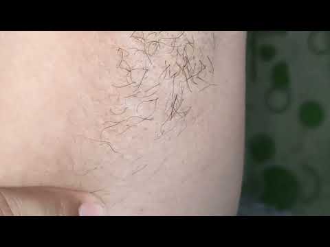 Hairy armpits update 3 || Mommy Ivy