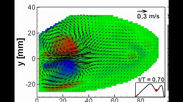 PIV flow visualization of diastolic flow in left ventricle phantom model