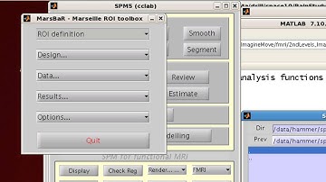 SPM MarsBar Tutorial: Creating ROIs from Coordinates